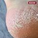 Трояндовий крем з сечовиною для ніг 125 мл (ROSE CREAM), PEDIBAEHR BAEHR-11060 фото 3