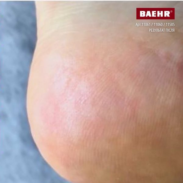Трояндовий крем з сечовиною для ніг 30мл (ROSE CREAM), PEDIBAEHR BAEHR-11061 фото