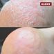 Крем-піна з 10% сечовиною та маслом троянди для ніг 125мл (CREMESCHAUM ROSE), PEDIBAEHR BAEHR-10970 фото 2